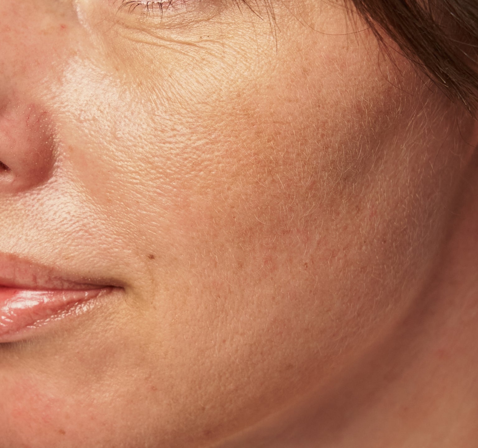 Sådan plejer du bedst kombineret hud