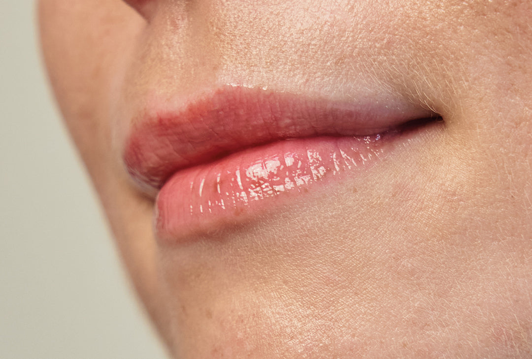 Hvordan slipper jeg af med tørre og sprukne læber?