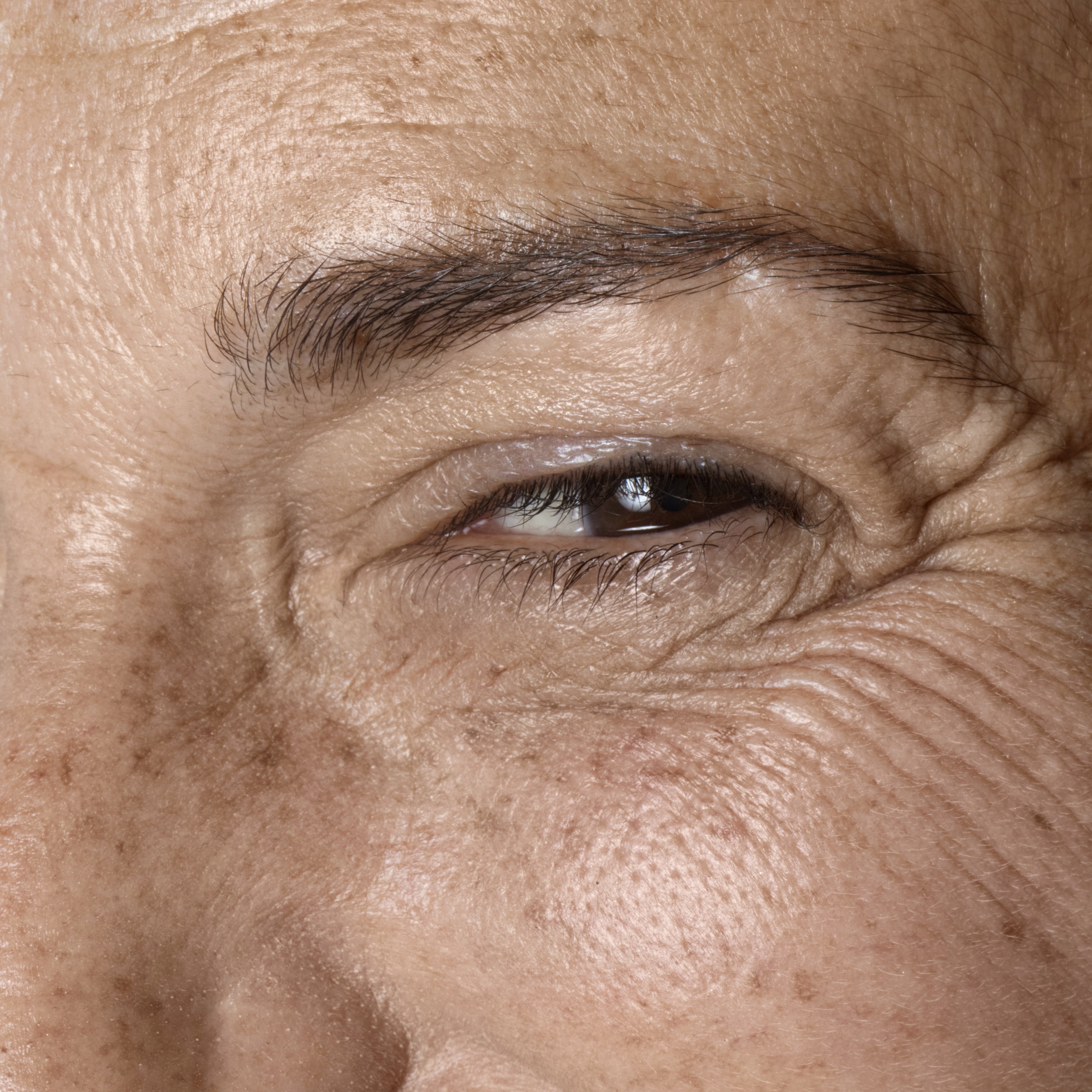 Hvad kan man gøre for at mindske rynker?