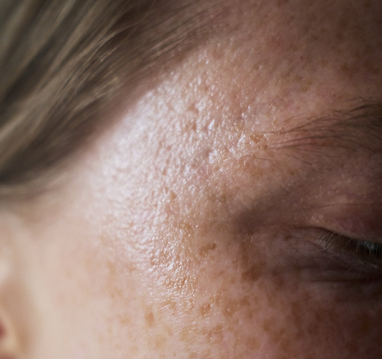 Beskyt din sensitive hud med de rette produkter