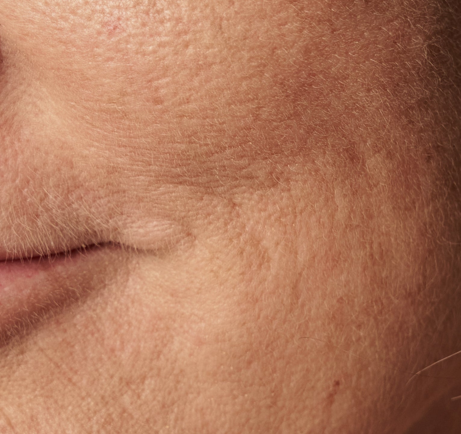 Hvad er dehydreret hud? Og hvordan ser dehydreret hud ud?